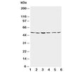 Western blot testing of Presenilin 2 antibody and Lane 1: rat brain; 2: rat brain; 3: MCF-7; 4: HeLa; 5: SMMC-7721; 6: CEM lysate. Predicted/observed molecular weight: ~50kDa.
