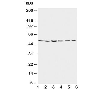 Western blot testing of Presenilin 2 antibody and Lane 1: rat brain; 2: rat brain; 3: MCF-7; 4: HeLa; 5: SMMC-7721; 6: CEM lysate. Predicted/observed molecular weight: ~50kDa.