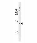 DUSP13 antibody western blot analysis in A2058 lysate