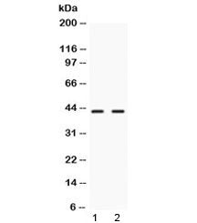Western blot testing of 1) rat liver and 2) human HeLa lysate with NR2F6 antibody at 0.5ug/ml. Predicted/observed molecular weight ~43 kDa.