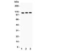 Western blot testing of TRPC5 antibody and Lane 1: HeLa; 2: U87; 3: COLO320. Expected size ~111KD