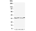 Western blot testing of Caspase-6 antibody and Lane 1: rat liver; 2: rat kidney; 3: rat testis; 4: NRK; 5: mouse liver; 6: mouse kidney; 7: mouse testis tissue lysate. Predicted molecular weight: ~33 kDa (precursor).