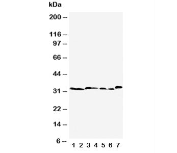 Western blot testing of Caspase-6 antibody and Lane 1: rat liver; 2: rat kidney; 3: rat testis; 4: NRK; 5: mouse liver; 6: mouse kidney; 7: mouse testis tissue lysate. Predicted molecular weight: ~33 kDa (precursor).