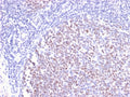 IHC staining of FFPE human tonsil with recombinant Bcl6 antibody (clone BCL6/2497R). HIER: boil tissue sections in pH 9 10mM Tris with 1mM EDTA for 20 min and allow to cool before testing.