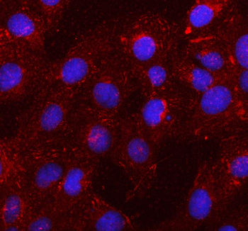 Immunofluorescent staining of SSH1 using anti-SSH1 antibody (red). SSH1 was detected in an immunocytochemical section of U2OS cells. Enzyme antigen retrieval was performed using IHC enzyme antigen retrieval reagent for 15 mins. The cells were blocked with 10% goat serum. And then incubated with 5 ug/ml rabbit anti-SSH1 antibody overnight at 4oC. Cy3 Conjugated Goat Anti-Rabbit IgG was used as secondary antibody at 1:500 dilution and incubated for 30 min at 37oC.