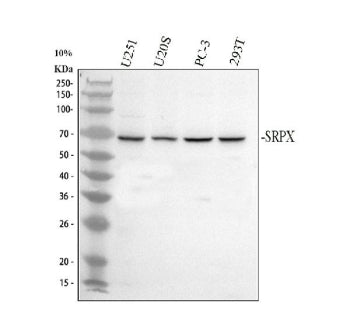 Western blot analysis of SRPX using anti-SRPX antibody. Electrophoresis was performed on a 10% SDS-PAGE gel at 80V (Stacking gel) / 120V (Resolving gel) for 2 hours. Lane 1: human U251 whole cell lysates, Lane 2: human U2OS whole cell lysates, Lane 3: human PC-3 whole cell lysates, Lane 4: human 293T whole cell lysates. After electrophoresis, proteins were transferred to a nitrocellulose membrane at 150 mA for 50-90 min. Blocked the membrane with 5% non-fat milk/TBS for 1.5 hour at RT.