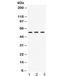 Western blot testing of 1) rat heart, 2) mouse liver and 3) human HeLa lysate with TGF beta receptor I antibody at 0.5ug/ml. Predicted/observed molecular weight ~55 kDa.