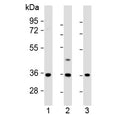 Western blot testing of human 1) U-87 MG, 2) U-2 OS and 3) MDA-MB-231 cell lysate with OR2AE1 antibody at 1:1000. Predicted molecular weight ~37 kDa.