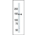 Western blot testing of mouse liver tissue lysate with CrkRS antibody. Predicted molecular weight ~164 kDa.