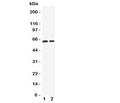 Western blot testing of OCT1 antibody and Lane 1: human HeLa cell lysate; 2: human A549 cell lysate. Predicted molecular weight ~61 kDa but this glycoprotein may be observed at up to ~80 kDa.