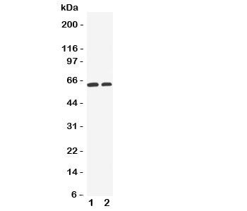 Western blot testing of OCT1 antibody and Lane 1: human HeLa cell lysate; 2: human A549 cell lysate. Predicted molecular weight ~61 kDa but this glycoprotein may be observed at up to ~80 kDa.