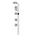 Western blot testing of human Jurkat cell lysate with ATG4C antibody. Predicted molecular weight ~52 kDa.