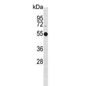 Western blot testing of human Jurkat cell lysate with ATG4C antibody. Predicted molecular weight ~52 kDa.