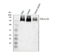 Western blot analysis of PIK3C2B using anti-PIK3C2B antibody. Electrophoresis was performed on a 8% SDS-PAGE gel at 80V (Stacking gel) / 120V (Resolving gel) for 2 hours. Lane 1: human placenta tissue lysates, Lane 2: mouse thymus tissue lysates. After electrophoresis, proteins were transferred to a nitrocellulose membrane at 150 mA for 50-90 min. Blocked the membrane with 5% non-fat milk/TBS for 1.5 hour at RT.