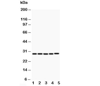 Western blot testing of CD40L antibody and Lane 1: MCF-7; 2: HeLa; 3: Jurkat; 4: HMY2; 5: COLO320; Expected molecular weight: 29-39 kDa (depending on glycosylation level) or ~18 kDa (soluble form).