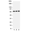 Western blot testing of SERT antibody and Lane 1: U87; 2: HeLa; 3: Jurkat cell lysate. Expected molecular weight: ~70/85-95kDa (unmodified/glycosylated).