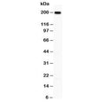 Western blot testing of Integrin beta 4 antibody and A431 lysate; Predicted molecular weight ~200 kDa.