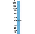 Western blot testing of human Raji cell lysate with recombinant CD23 antibody at 1:500 dilution. Expected molecular weight: 37~45 kDa.