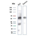Western blot testing of human Raji and Ramos cell lysate with recombinant CD27 antibody. Predicted molecular weight ~29 kDa but may be observed at higher molecular weights due to glycosylation.