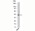 Western blot testing of human samples using Viperin antibody at 3ug/ml.