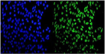 Immunofluorescent staining of FFPE human U-2 OS cells with MEF2A antibody (green) and DAPI nuclear stain (blue). HIER: steam section in pH6 citrate buffer for 20 min.