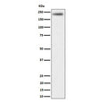 Western blot testing of human HeLa cell lysate with DENN antibody. Predicted molecular weight ~176 kDa.