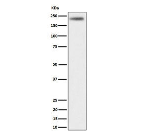 Western blot testing of human HeLa cell lysate with DENN antibody. Predicted molecular weight ~176 kDa.