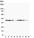 Western blot testing of MEK3 antibody and Lane 1: rat spleen; 2: rat thymus; 3: rat skeletal muscle; 4: rat kidney, and human samples 5: MCF-7; 6: HeLa; 7: Raji; 8: CEM; 9: COLO320 cell lysate. Expected/observed molecular weight ~39 kDa.