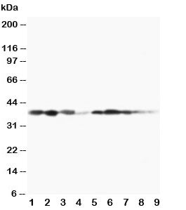 Western blot testing of MEK3 antibody and Lane 1: rat spleen; 2: rat thymus; 3: rat skeletal muscle; 4: rat kidney, and human samples 5: MCF-7; 6: HeLa; 7: Raji; 8: CEM; 9: COLO320 cell lysate. Expected/observed molecular weight ~39 kDa.