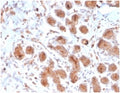 IHC staining of FFPE human breast tissue with LTF antibody (clone LTF/4073). HIER: boil tissue sections in pH 9 10mM Tris with 1mM EDTA for 20 min and allow to cool before testing.