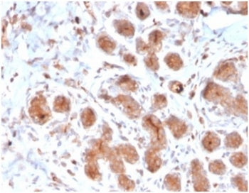 IHC staining of FFPE human breast tissue with LTF antibody (clone LTF/4073). HIER: boil tissue sections in pH 9 10mM Tris with 1mM EDTA for 20 min and allow to cool before testing.