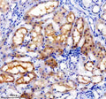 IHC staining of FFPE human kidney tissue with TRAIL-R4 antibody, HRP-secondary and DAB substrate. HIER: boil tissue sections in pH8 EDTA for 20 min and allow to cool before testing.
