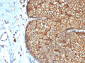 IHC staining of FFPE human sebaceous gland with recombinant Acidic Cytokeratin antibody (clone rKRTL/6616). HIER: boil tissue sections in pH 9 10mM Tris with 1mM EDTA for 20 min and allow to cool before testing.