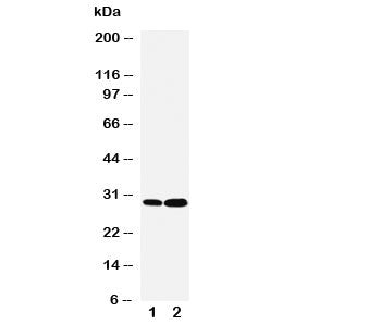 Western blot testing of LASP1 antibody and Lane 1: HeLa; 2: MCF-7 cell lysate. Predicted molecular weight: 30kDa.