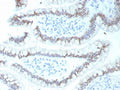 IHC staining of FFPE human colon tissue with recombinant CDX2 antibody (clone CDX2/9298R). HIER: boil tissue sections in pH 9 10mM Tris with 1mM EDTA for 20 min and allow to cool before testing.