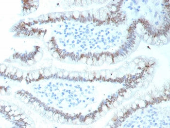 IHC staining of FFPE human colon tissue with recombinant CDX2 antibody (clone CDX2/9298R). HIER: boil tissue sections in pH 9 10mM Tris with 1mM EDTA for 20 min and allow to cool before testing.