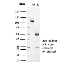 SDS-PAGE analysis of purified, BSA-free CD7 antibody (clone HuLy-m2) as confirmation of integrity and purity.