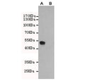 Western blot testing of A) CHO-K1 cells transfected with a partial ERa protein and B) untransfected CHO-K1 cell lysate using Estrogen Receptor alpha antibody at 1:2000. Expected size of the partial protein ~50 kDa.