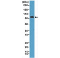 Western blot testing of human HeLa cell lysate with recombinant Transferrin Receptor antibody at 1:1000 dilution. Predicted molecular weight 85~95 kDa.