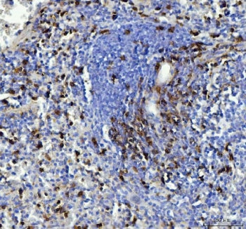 IHC testing of FFPE mouse spleen tissue with CD90 antibody. Required HIER: steam section in pH8 EDTA for 20 min and allow to cool prior to testing.