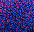 Immunofluorescent staining of TYRP1 using anti-TYRP1 antibody (red). TYRP1 was detected in a paraffin-embedded section of human melanoma tissue. Heat mediated antigen retrieval was performed in EDTA buffer (pH 8.0, epitope retrieval solution). The tissue section was blocked with 10% goat serum. The tissue section was then incubated with 5 ug/ml rabbit anti-TYRP1 antibody overnight at 4oC. Cy3 Conjugated Goat Anti-Rabbit IgG was used as secondary antibody at 1:500 dilution and incubated for 30 min at 37oC.