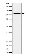Western blot analysis of SEC24D expression in human HeLa cell lysate using SEC24D antibody. Predicted molecular weight ~113 kDa.