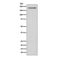 Western blot testing of human SH-SY5Y cell lysate with PDGFRA antibody. Expected molecular weight: 120-195 kDa.