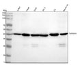 Western blot analysis of TMEM43 using anti-TMEM43 antibody. Lane 1: human Jurkat whole cell lysates, Lane 2: human Hacat whole cell lysates, Lane 3: human SiHa whole cell lysates, Lane 4: human PC-3 whole cell lysates, Lane 5: rat C6 whole cell lysates, Lane 6: mouse Neuro-2a whole cell lysates. After electrophoresis, proteins were transferred to a nitrocellulose membrane at 150 mA for 50-90 min. Blocked the membrane with 5% non-fat milk/TBS for 1.5 hour at RT.