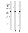 Western blot testing of ERCC1 antibody at 1:2000 dilution. Lane 1: A549 lysate; 2: HeLa lysate; 3: T47D lysate. Predicted molecular weight ~36kDa.