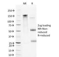 SDS-PAGE Analysis of Purified, BSA-Free VCAM1 Antibody (clone B-K9). Confirmation of Integrity and Purity of the Antibody.