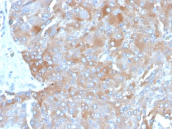 IHC staining of FFPE human adrenal gland tissue with IL-3 antibody (clone IL3/4003). HIER: boil tissue sections in pH 9 10mM Tris with 1mM EDTA for 20 min and allow to cool before testing.