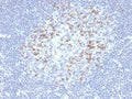 IHC staining of FFPE human lymph node tissue with PD1 (CD279) antibody (clone PDCD1/4231R). HIER: boil tissue sections in pH 9 10mM Tris with 1mM EDTA for 20 min and allow to cool before testing.