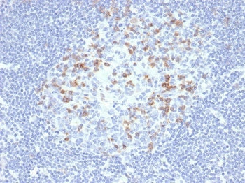 IHC staining of FFPE human lymph node tissue with PD1 (CD279) antibody (clone PDCD1/4231R). HIER: boil tissue sections in pH 9 10mM Tris with 1mM EDTA for 20 min and allow to cool before testing.