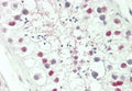 IHC testing of FFPE human testis tissue with HOXA3 antibody. HIER: steam section in pH6 citrate buffer for 20 min and allow to cool prior to staining.